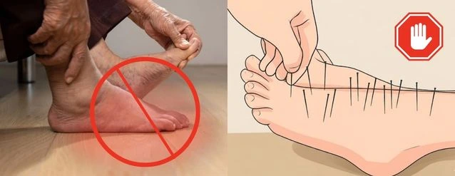 Nerve damage explanation